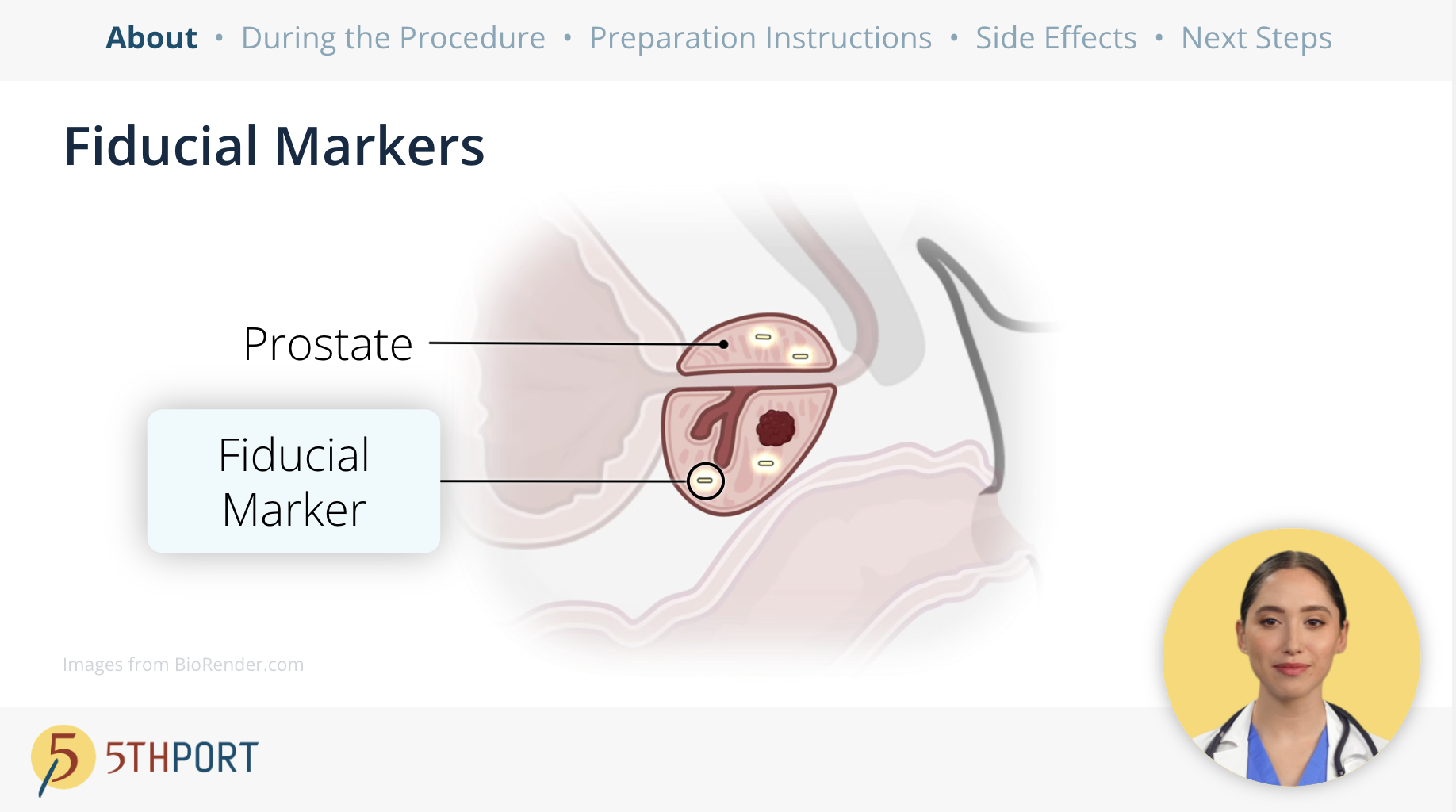 Brachytherapy Patient Education Workflow - Pre-Procedure Preparation