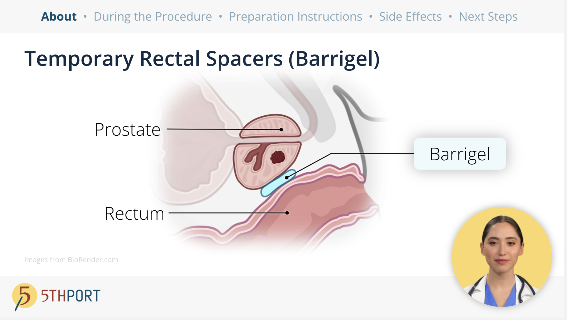 Brachytherapy Patient Education Workflow - Pre-Procedure Preparation