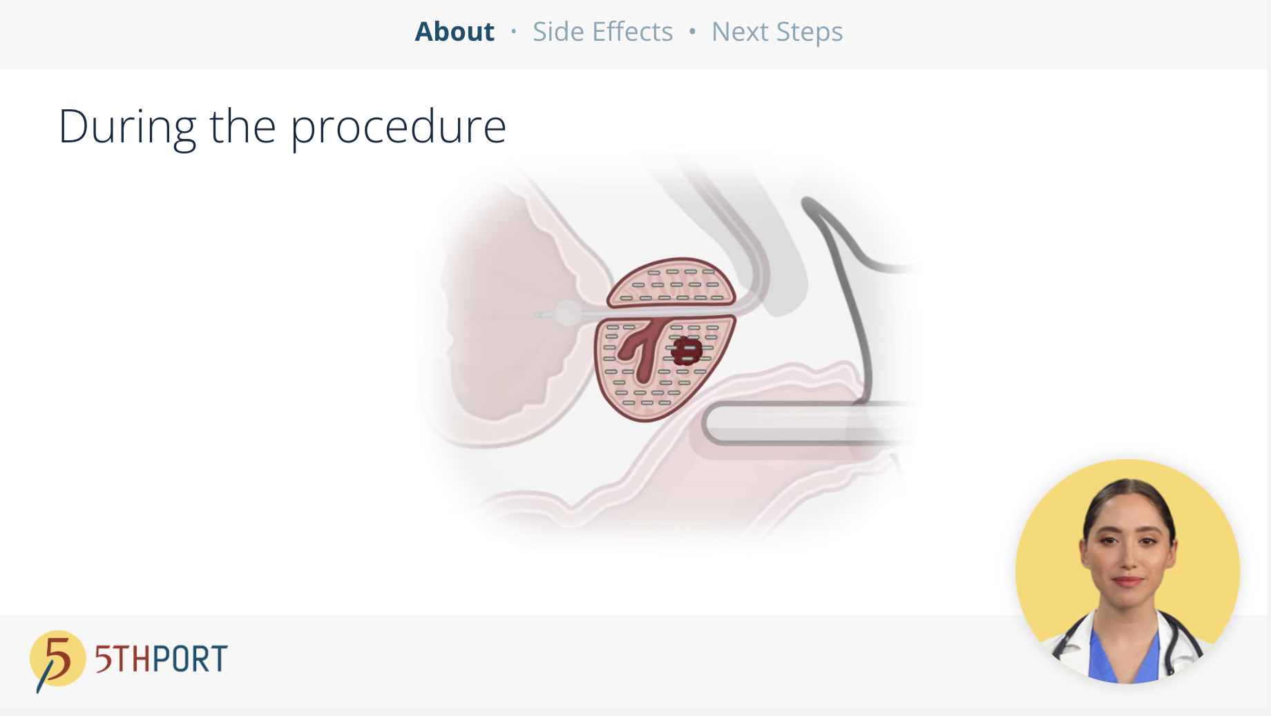 Brachytherapy Patient Education Workflow - Treatment Begins 2