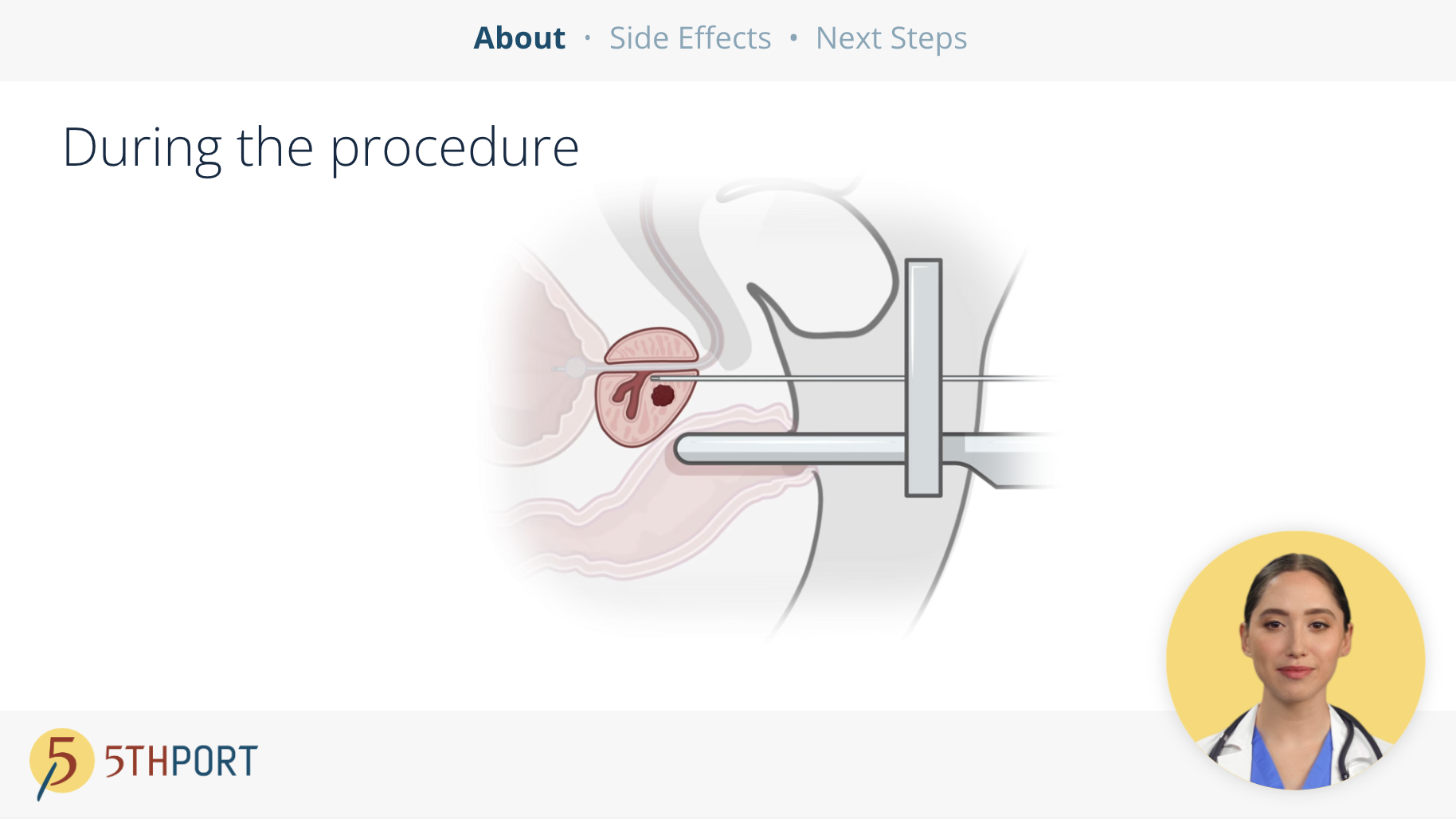 Brachytherapy Patient Education Workflow - Treatment Begins 4