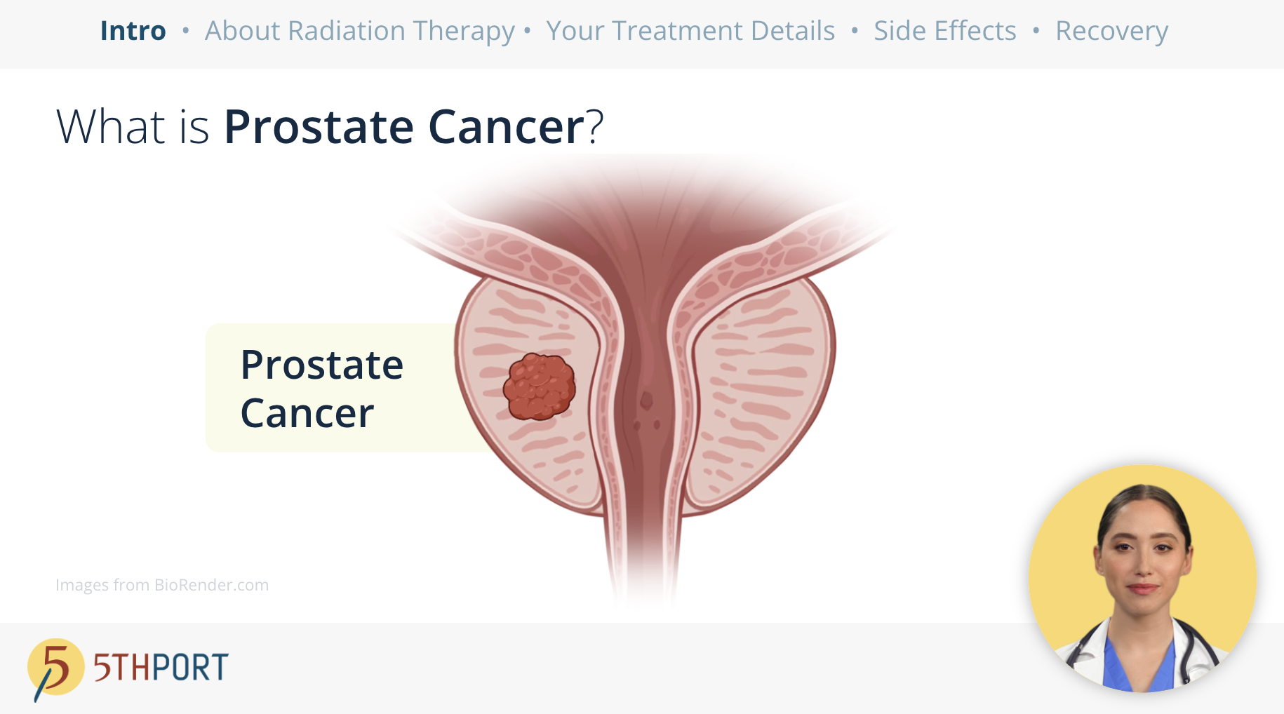 Brachytherapy Patient Education Workflow – Treatment Planning Brachytherapy Patient Education Workflow - Treatment Planning